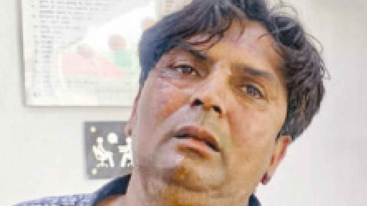 Gujarati Man held for attacking Delhi CM: My son loves dogs, he was upset after SC order says Mother