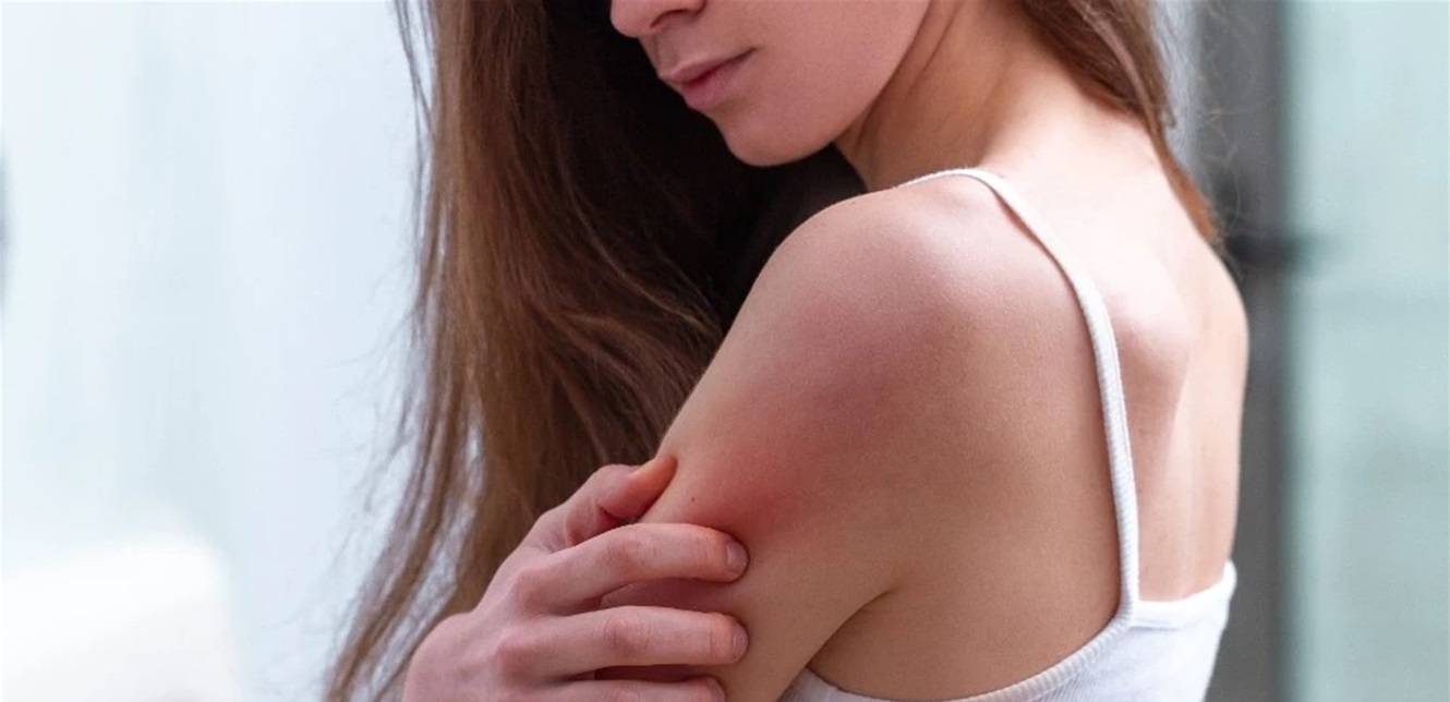 حكة 'غير متوقعة' قد تكون إنذاراً مبكرا لمرض السكري