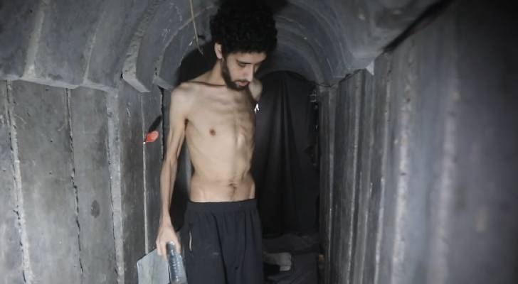 "They eat what we eat": Hamas shows 'Israeli' captive's health decline in new footage