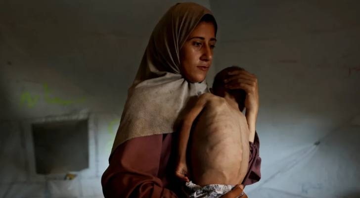 In one day, six Gazans die of hunger amid 'Israeli' blockade