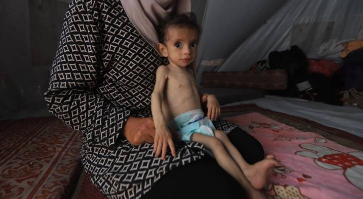 Malnutrition deaths climb to 235, including 106 children, says Gaza Media Office