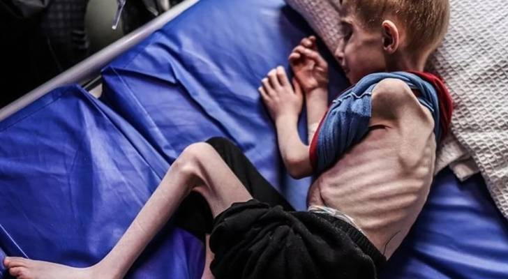 Gaza hunger crisis claims 11 lives in 24 hours, says Gaza health ministry