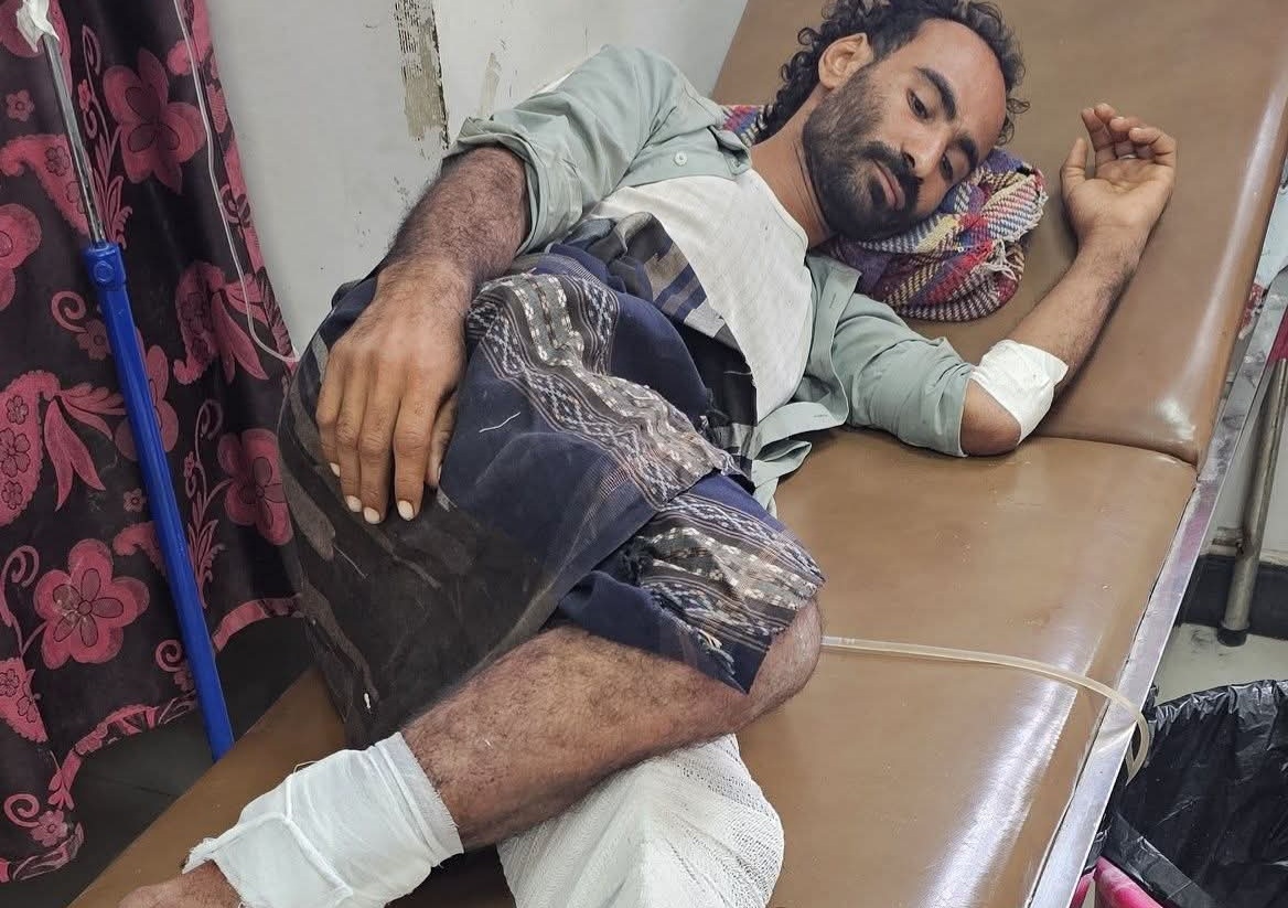 إصابة شاب برصاص قناص حوثي في مديرية مقبنة بتعز