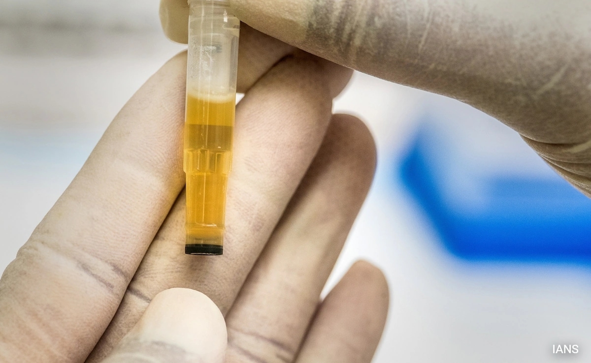 No Scientific Evidence To Prove Urine Therapy Can Treat Any Disease: Experts