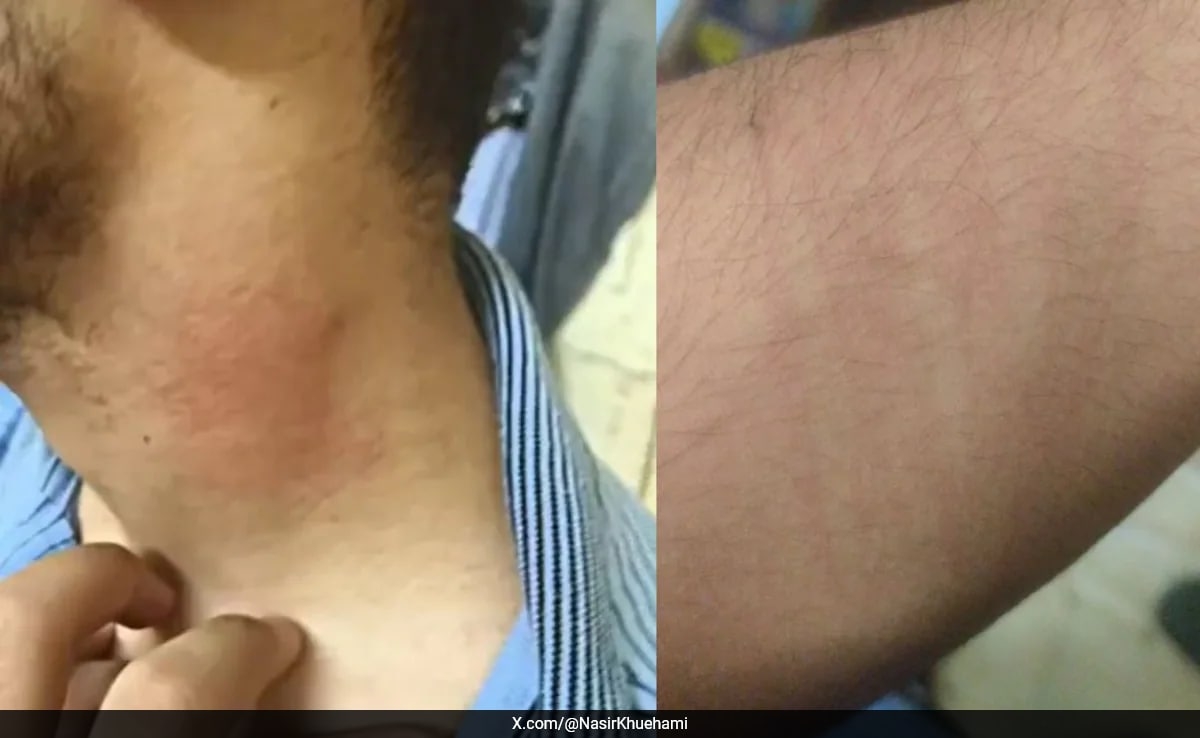 "Knocked Down, Slapped 8-9 Times": J&K Student Thrashed In Nagpur