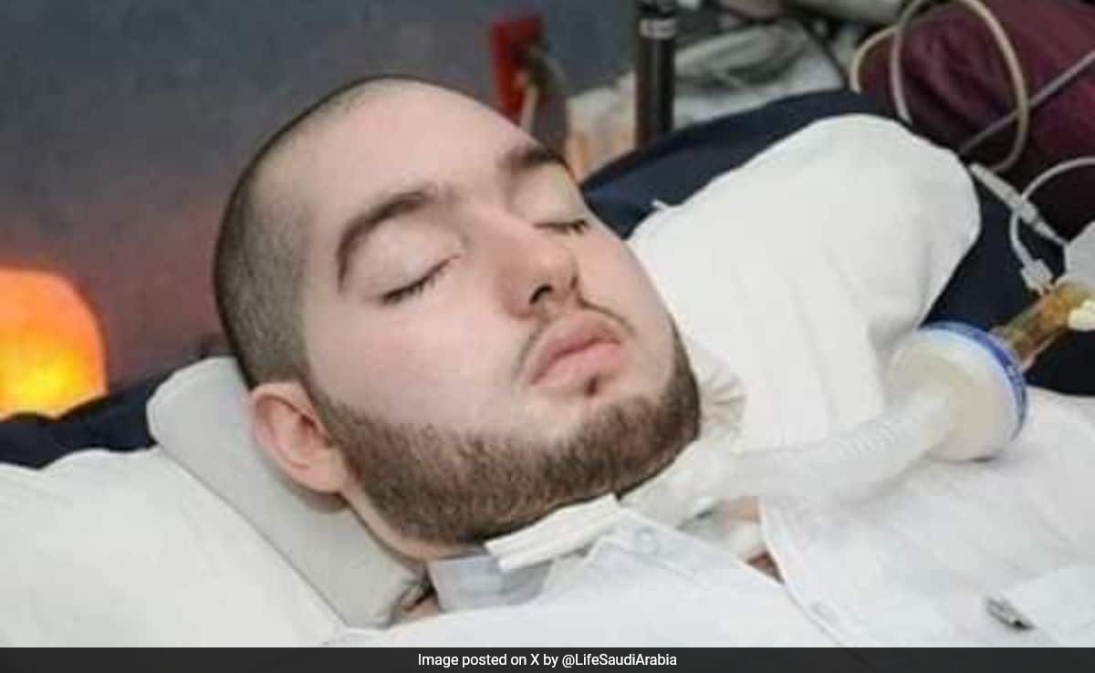 Saudi Arabia's "Sleeping Prince", In Coma For Nearly 20 Years, Turns 36