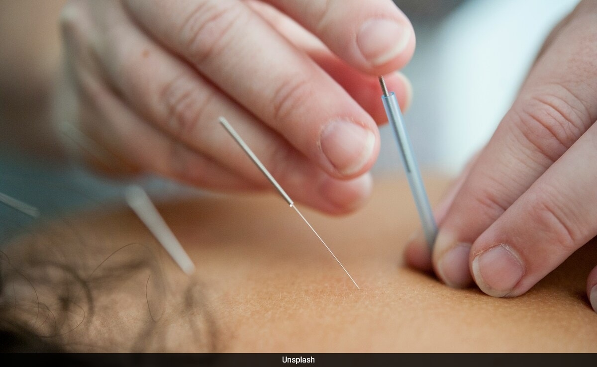 Chinese Man Hospitalised With Collapsed Lungs After Acupuncture Session