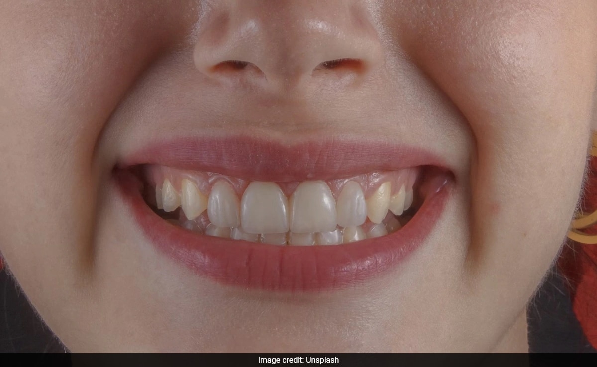 German Man Says Indians Have Good Dental Hygiene, Internet Divided