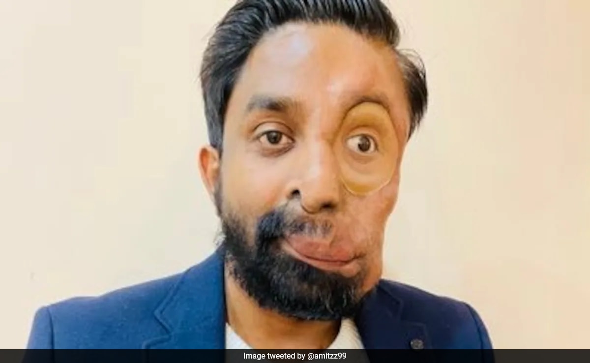 Indian-Origin Man Claims London Cafe Refused Him Service Because Of His Face: "Everyone Was Staring At Me"