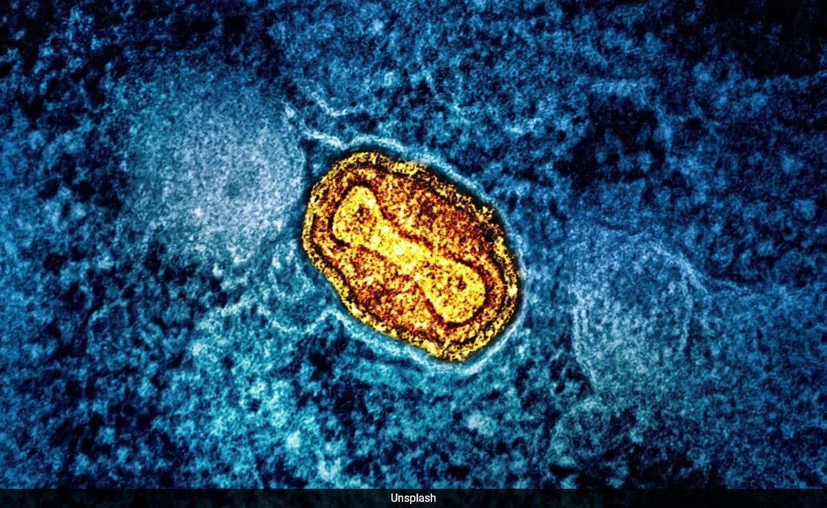 Hundreds Of New Giant Viruses Discovered In Global Waters: Study