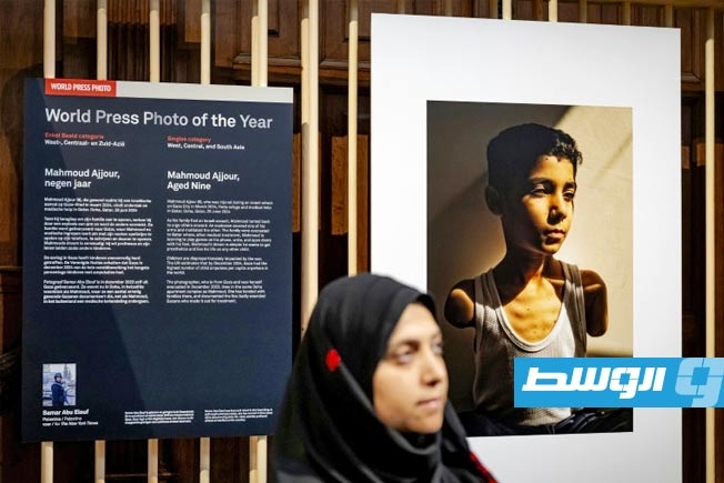 صورة طفل فلسطيني بترت ذراعاه تفوز بأعرق مسابقة للتصوير الصحفي