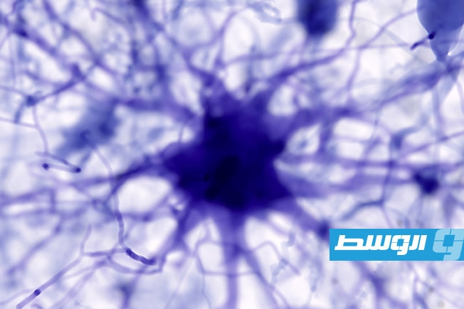 الذكاء الصناعي يكشف مفتاحًا جديدًا لعلاج ألزهايمر