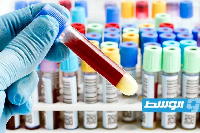 علامات خطيرة تكشف الإصابة بتعفن الدم.. لا تتجاهلها