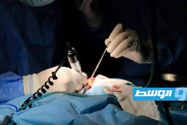 استئناف عمليات زراعة القوقعة للأطفال في مستشفى بن سينا بسرت