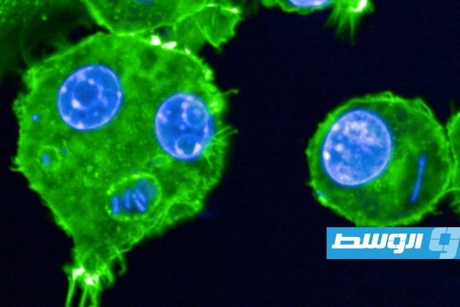 باحثون يحللون ميكروبات الماضي المرتبطة بالطاعون والجذام