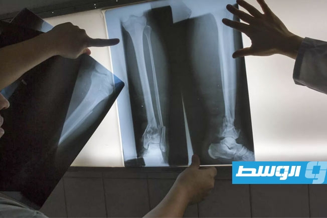 غرسات خشبية.. ثورة مستقبلية في الجراحة والطب الحيوي