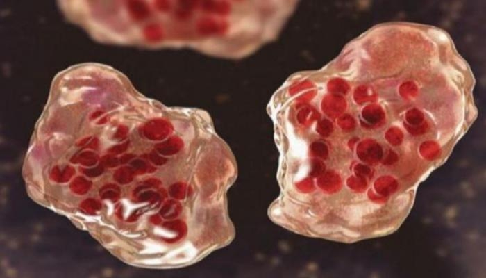 الحصبة تنتشر في أمريكا.. أكثر من 700 إصابة في ولايات مختلفة