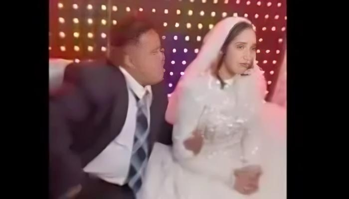 بعد فيديو «العروسة الباكية».. النيابة تحقق في زواج شاب متلازمة داون