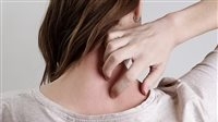 علامات خفية على البشرة تشير إلى الإصابة بداء السكري