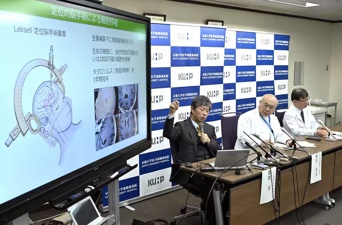 iPS Cell Research Can Give Japan Lead in Regenerative Medicine