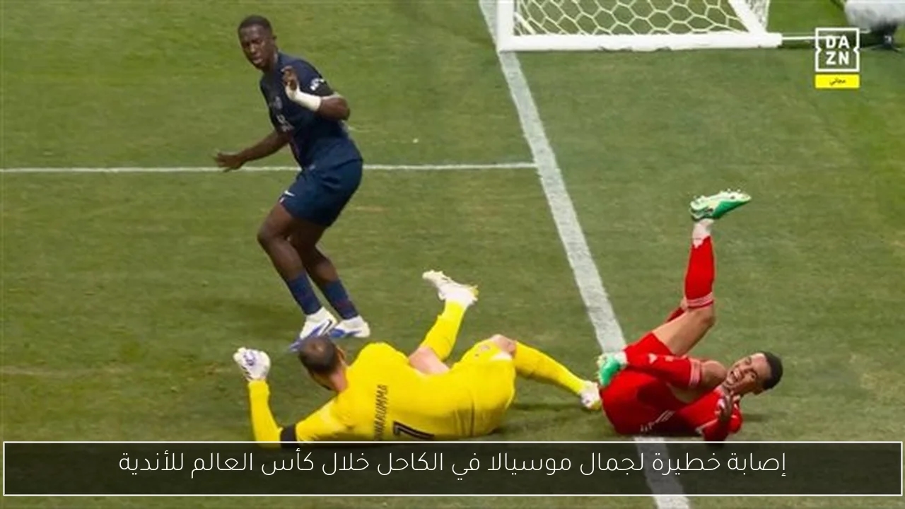 إصابة خطيرة لجمال موسيالا في الكاحل خلال كأس العالم للأندية