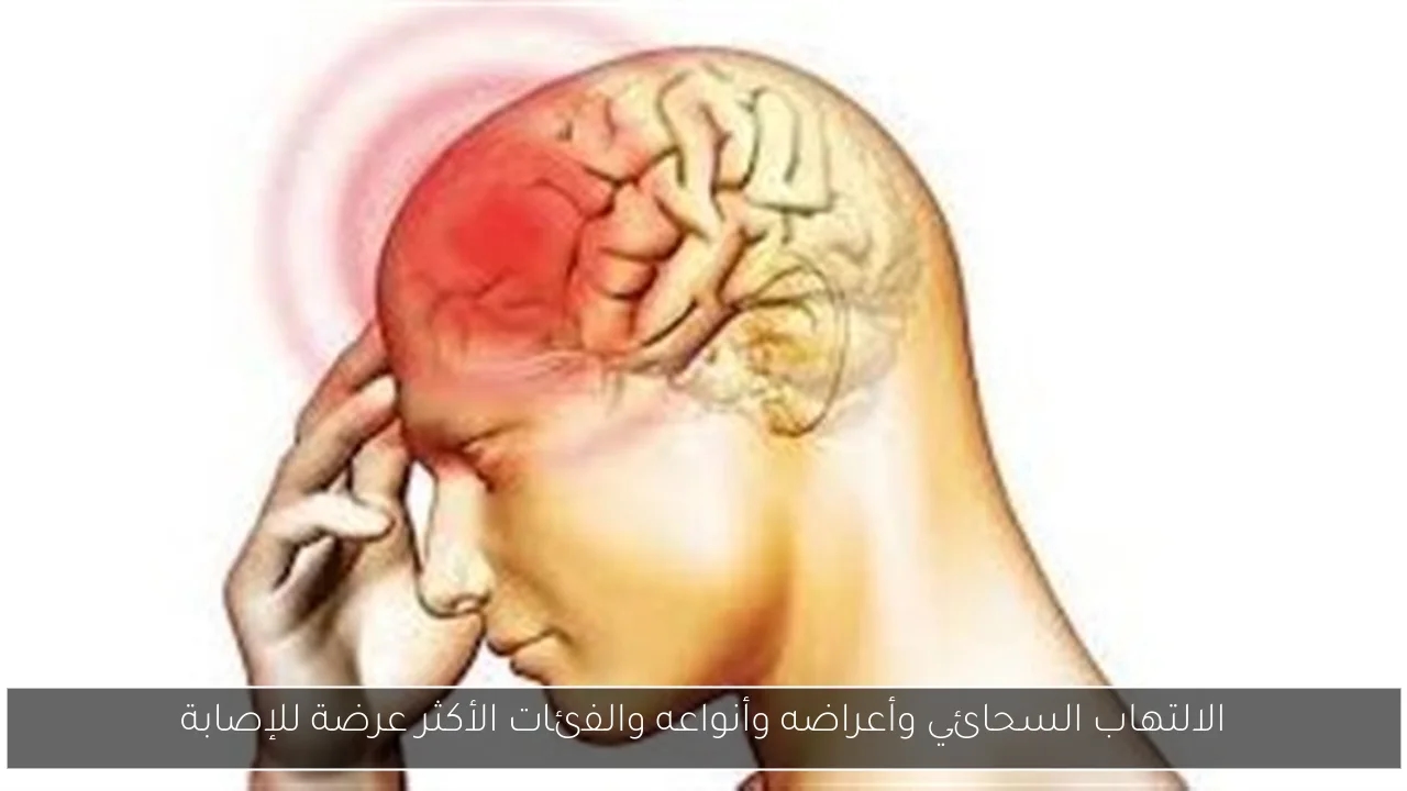 الالتهاب السحائي وأعراضه وأنواعه والفئات الأكثر عرضة للإصابة
