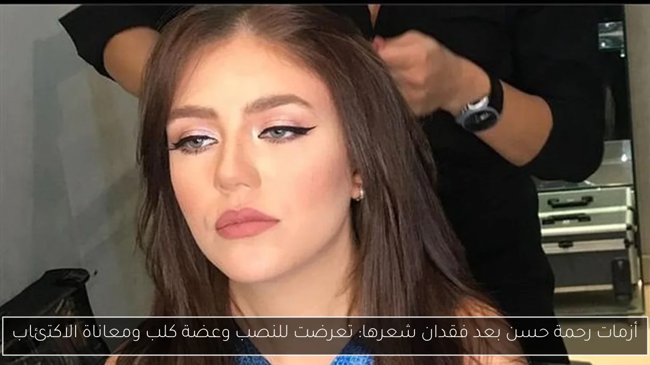 أزمات رحمة حسن بعد فقدان شعرها: تعرضت للنصب وعضة كلب ومعاناة الاكتئاب