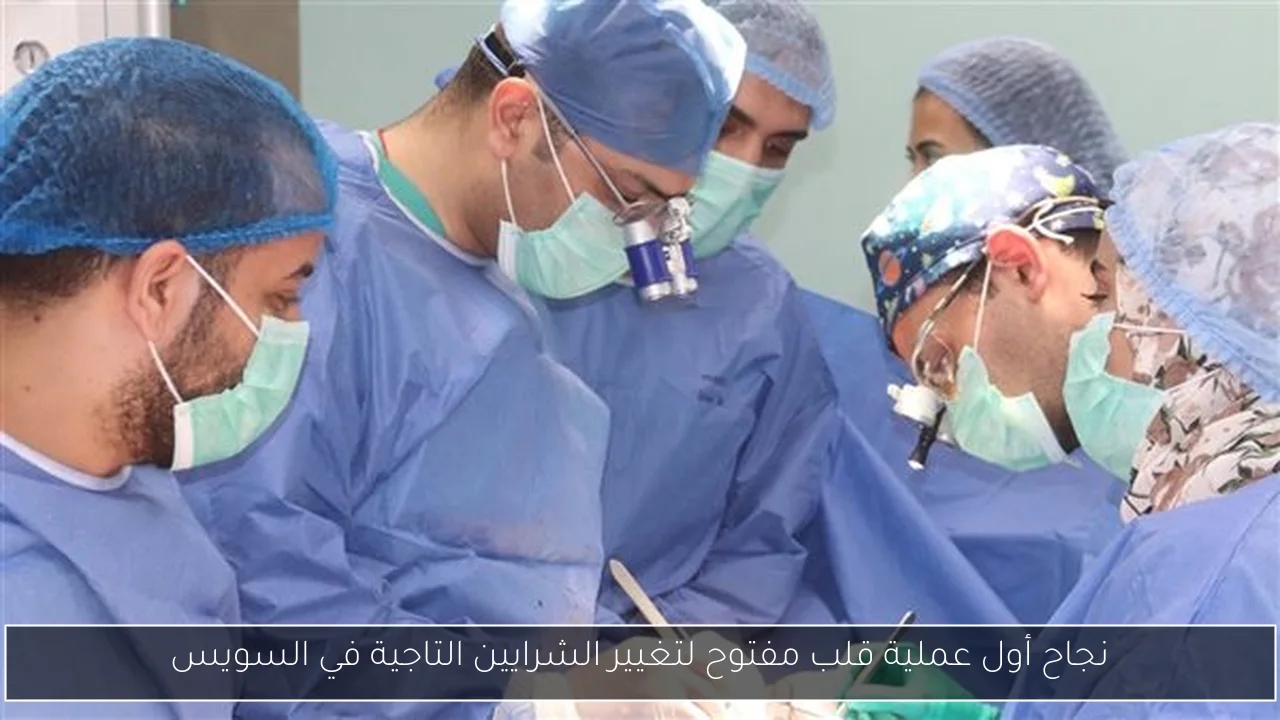 نجاح أول عملية قلب مفتوح لتغيير الشرايين التاجية في السويس