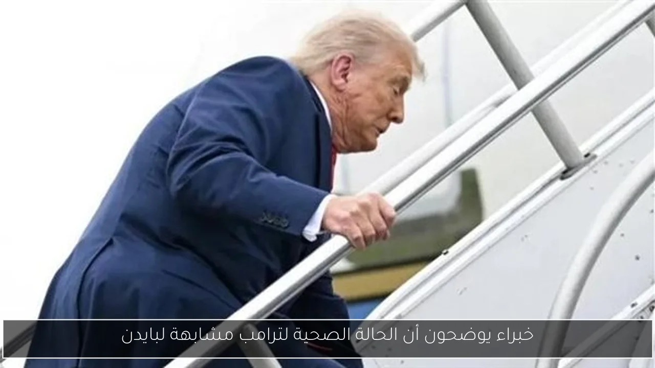 خبراء يوضحون أن الحالة الصحية لترامب مشابهة لبايدن
