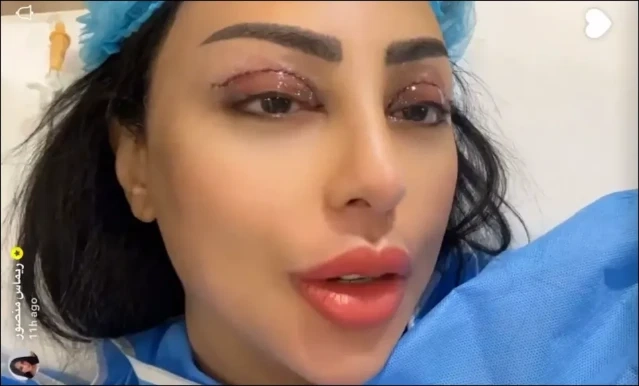 بالفيديو: فنانة عربية تثير الجدل بعد عملية تجميل الجفون