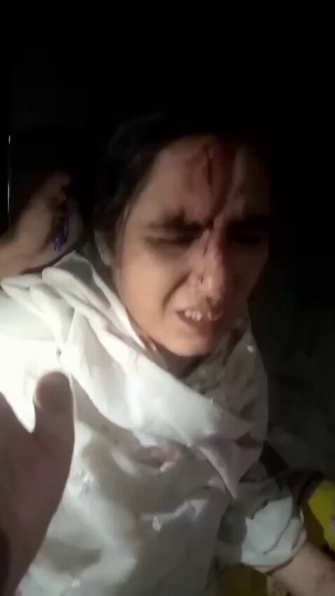 VIDEO: Pakistani woman wounded after Indian strikes