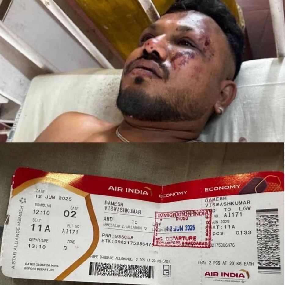 Viswashkumar Ramesh, a British national, is the only known survivor of Air India Flight 171