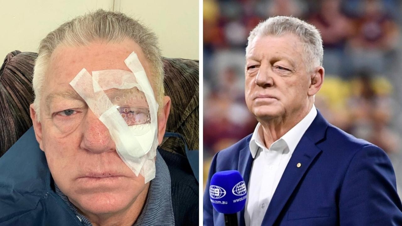 Concern for Phil Gould as gruesome eye photo goes viral