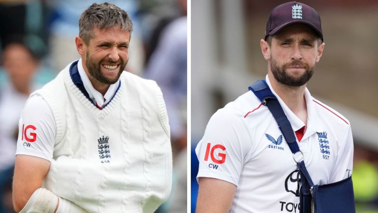 England star exposes gruesome detail behind viral cricket image
