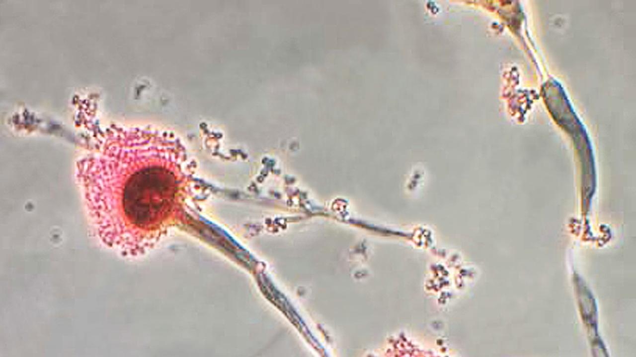 Global warning over fungi ‘that could eat you from inside out'