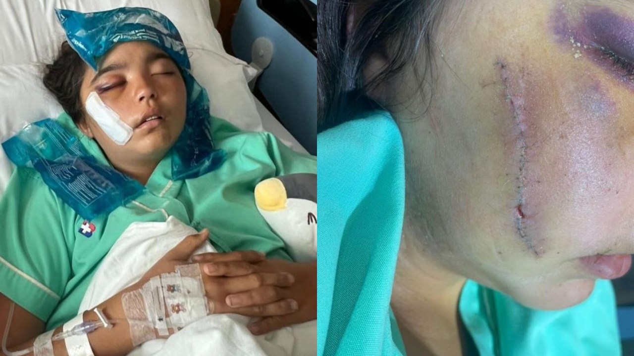 Aussie teen narrowly survives horror accident in Thailand after tour boat reverses over the 13-year-old
