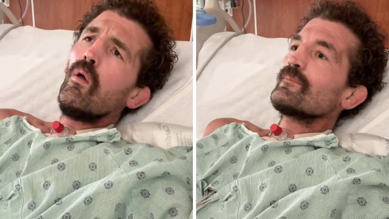 Unrecognisable ex-UFC fighter ‘died four times'