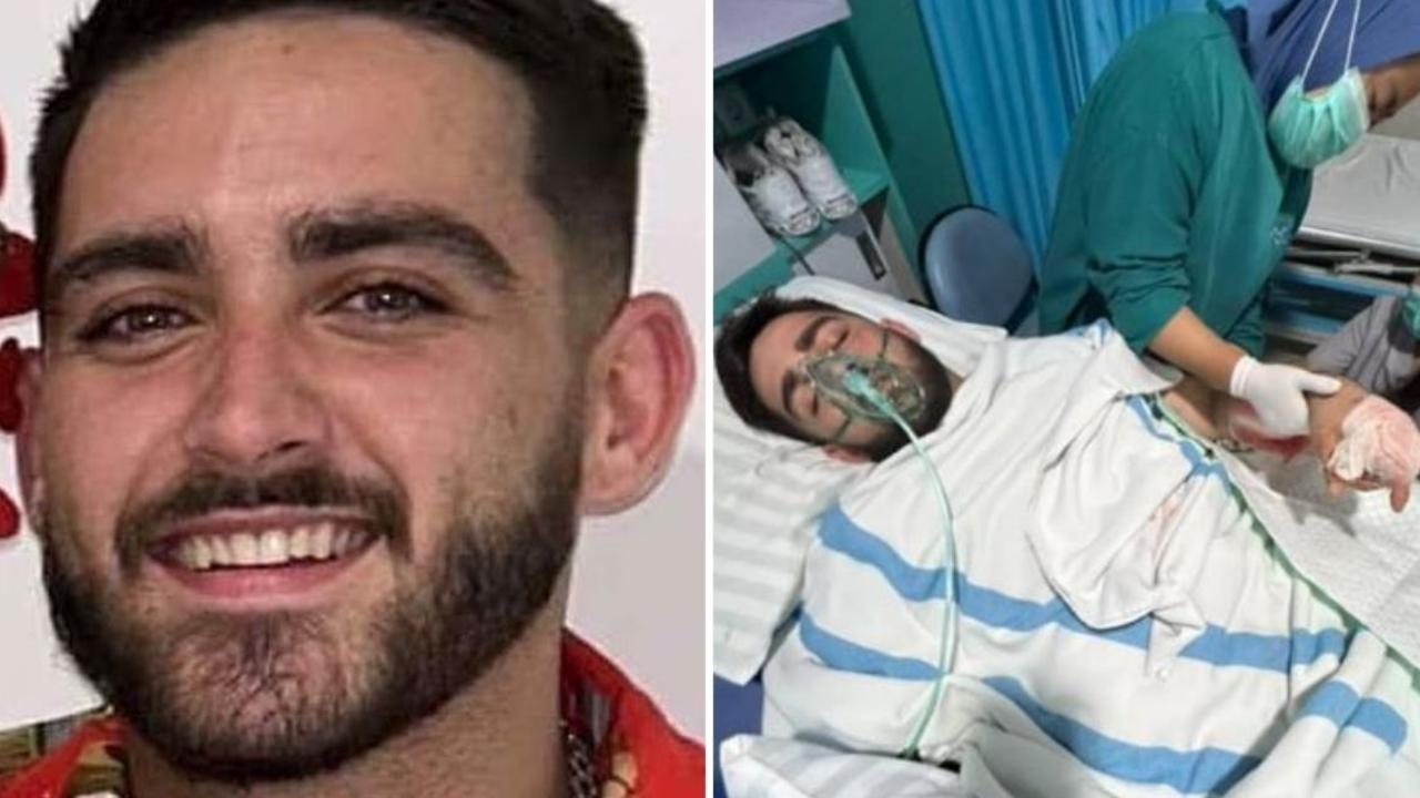 Young Australian dad faces ‘long road' after horror scooter crash in Bali