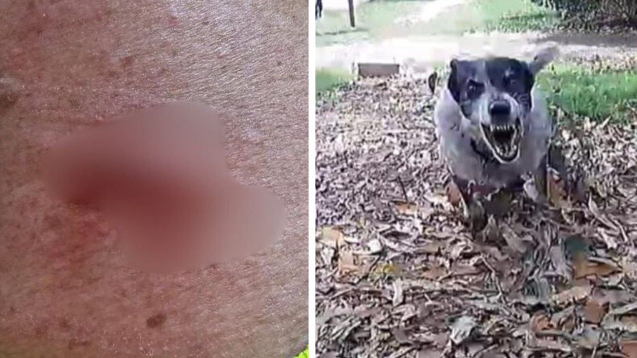 ‘Powerful jaws': Postie reveals horrific trauma after vicious dog attack on the job