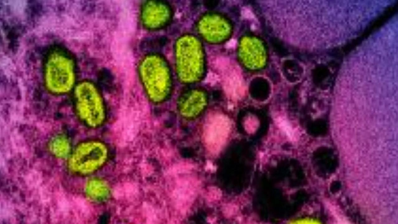 Queensland Health confirms Clade 1 strain of monkeypox detected, second time ever for Australia