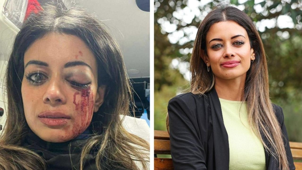 ‘What was that?': Fresh details in Greens candidate's injury in protestarrest