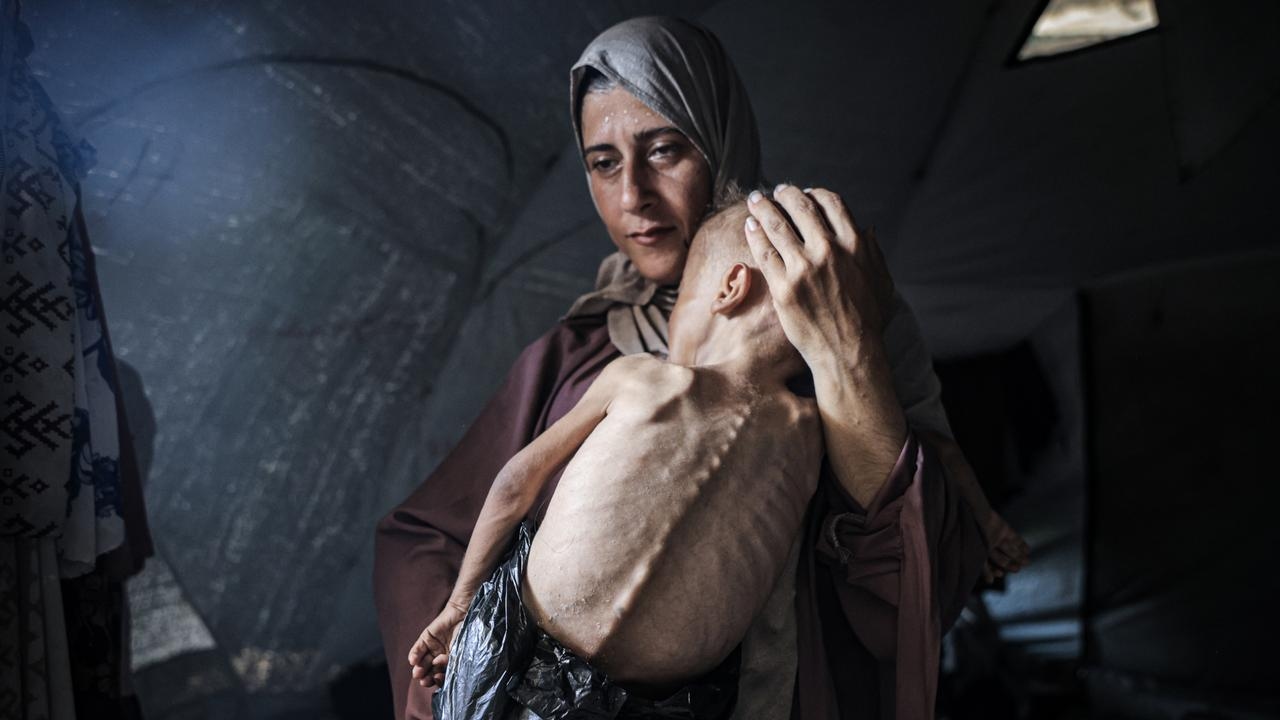 PM Albanese responds to viral Gaza photo, signals major shift on Palestinian state recognition