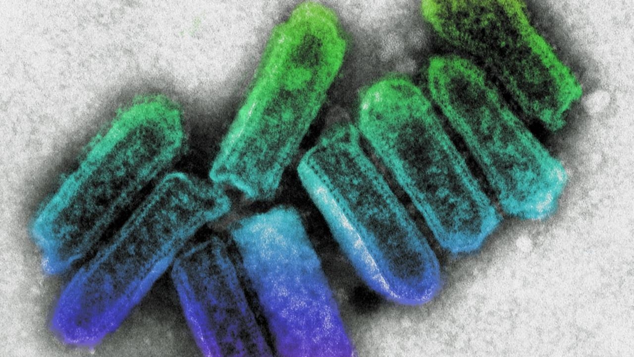 Everything we know about Lyssavirus after man dies in state first