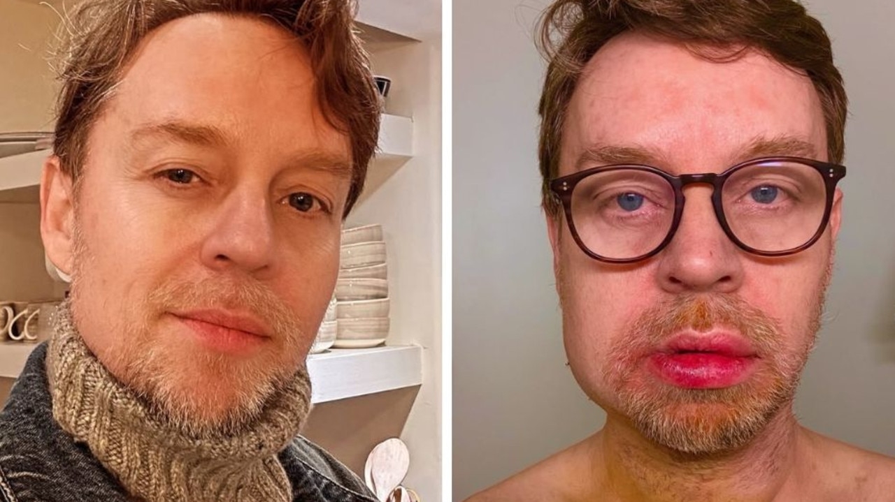 Savage Garden singer Darren Hayes suffered ‘terrible accident' two months after mother's death