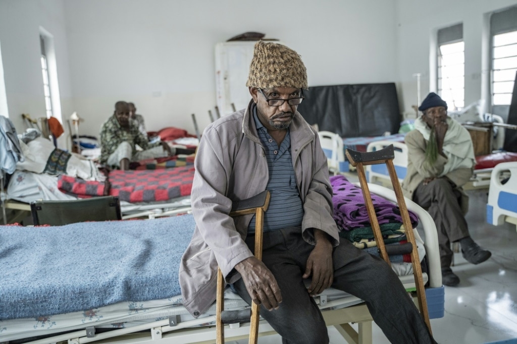 Patients with leprosy face lasting stigma in Ethiopia