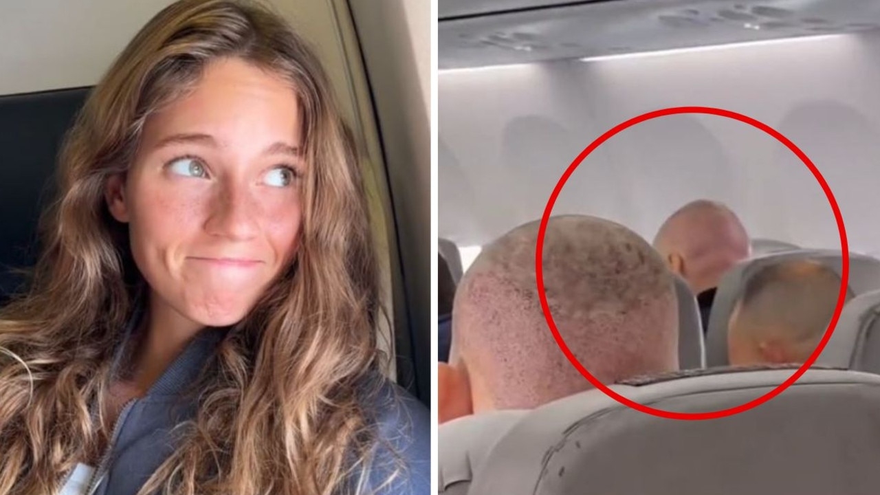 Hilarious ‘Turkish hairlines' clip lays bare huge trend