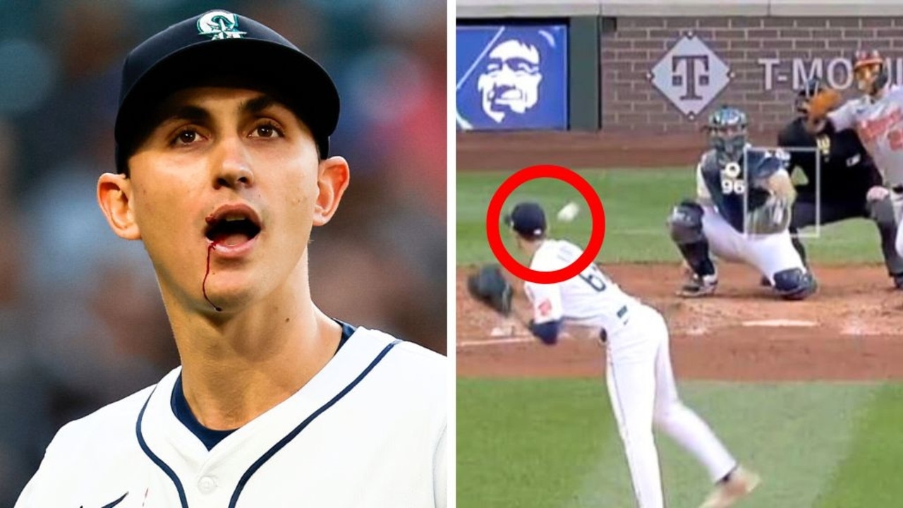 Mariners pitcher George Kirby takes 165km/h baseball to the face in scary scenes
