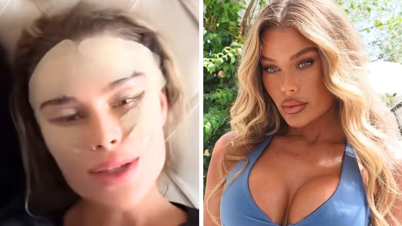 Skye Wheatley reveals how much she's spent on plastic surgery as she details most ‘horrific' one yet