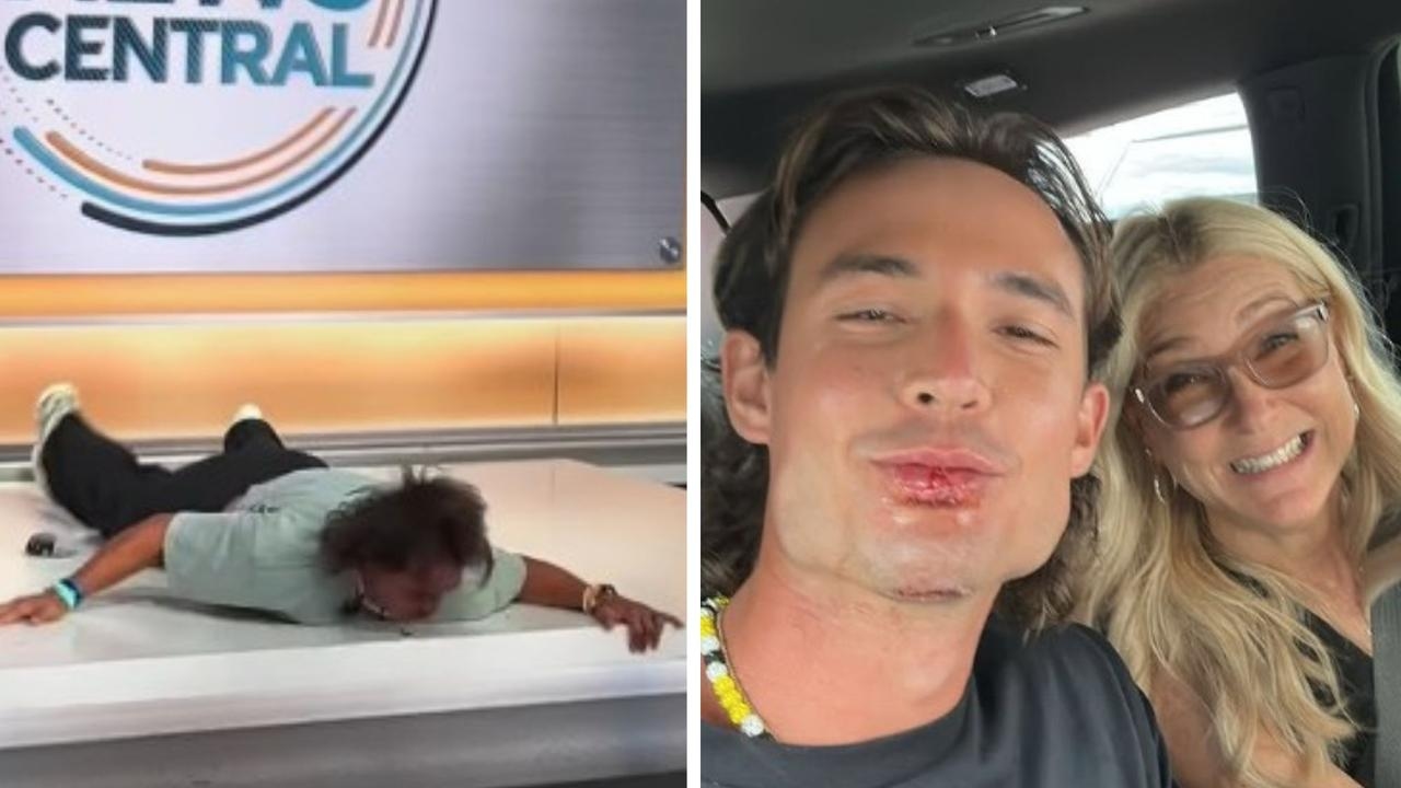 ‘Oh Jesus': Savannah Bananas baseballer's live TV backflip goes horribly wrong