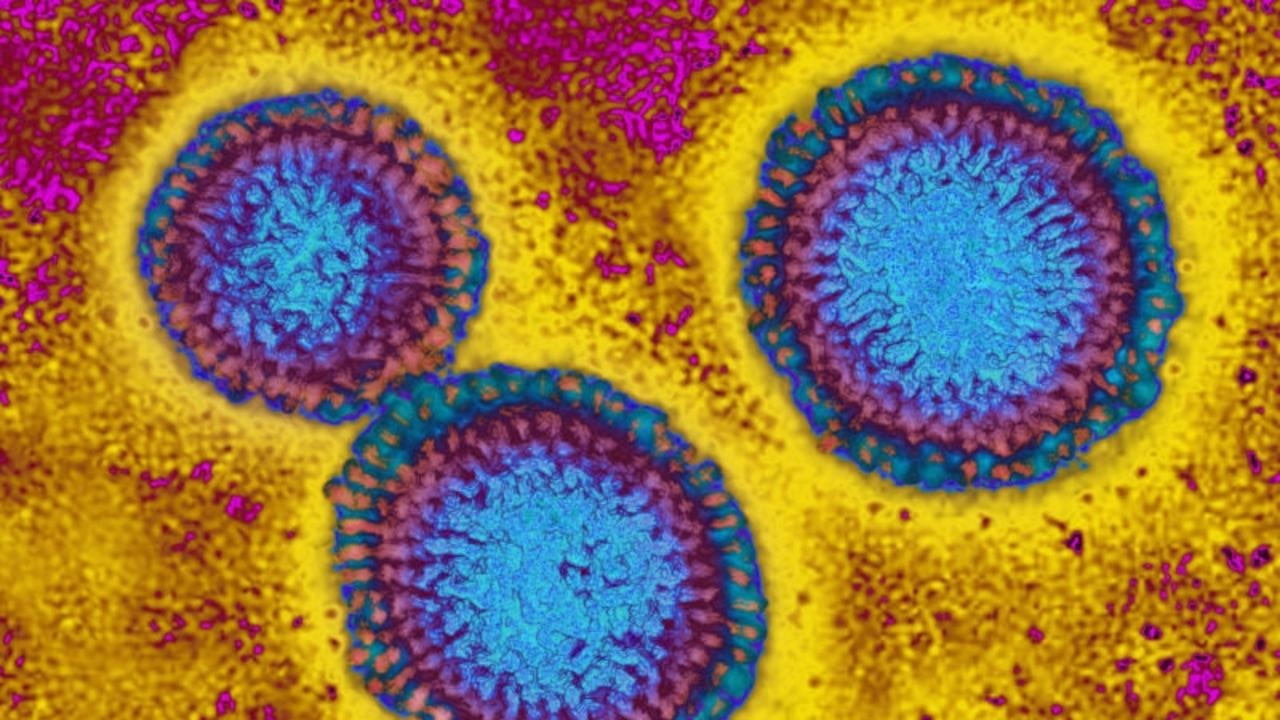 Australia records unseasonal flu surge, health experts alarmed